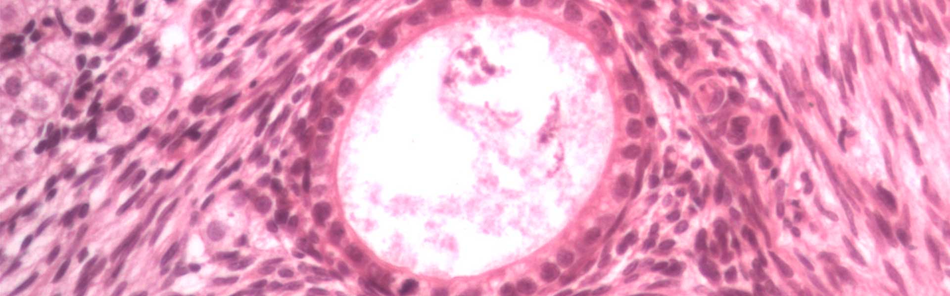 Folículo primario, ovario